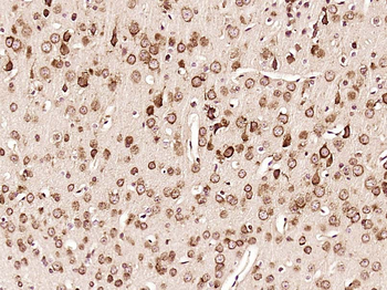 FABP3/H-FABP Rabbit Polyclonal Antibody