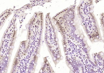 FUBP1 Rabbit Polyclonal Antibody