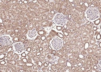 FDPS Rabbit Polyclonal Antibody