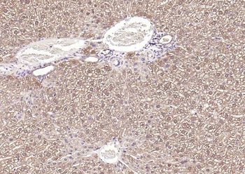 FDPS Rabbit Polyclonal Antibody