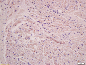FLNC Rabbit Polyclonal Antibody
