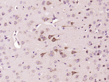 FSD1 Rabbit Polyclonal Antibody