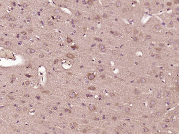 FSD1 Rabbit Polyclonal Antibody