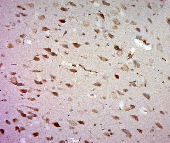 FSD1L Rabbit Polyclonal Antibody