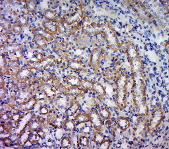 FSD1L Rabbit Polyclonal Antibody