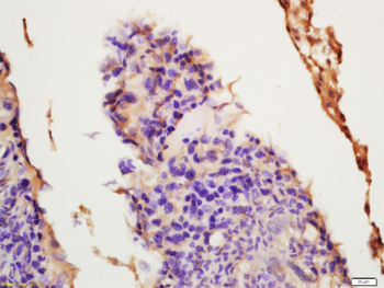 Galactosylceramidase Rabbit Polyclonal Antibody