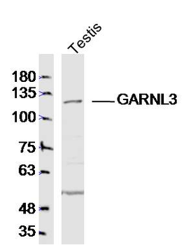 GARNL3 Rabbit Polyclonal Antibody