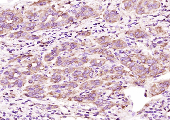 GIPC1 Rabbit Polyclonal Antibody
