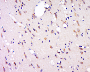 Phospho-GluR1 (Thr840) Rabbit Polyclonal Antibody