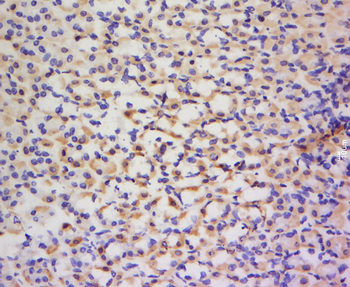 QARS/Glutamyl Prolyl tRNA synthetase/ProRS Rabbit Polyclonal Antibody