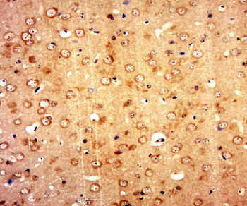 GORASP2 Rabbit Polyclonal Antibody