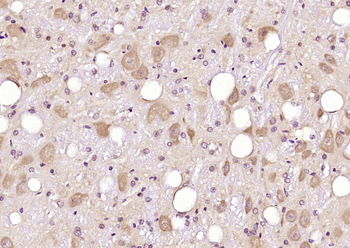 GOSR1 Rabbit Polyclonal Antibody