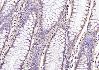 Phospho-HDAC7 (Ser155) Rabbit Polyclonal Antibody