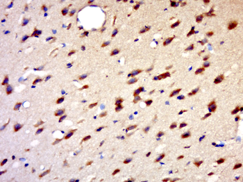 HENMT1 Rabbit Polyclonal Antibody