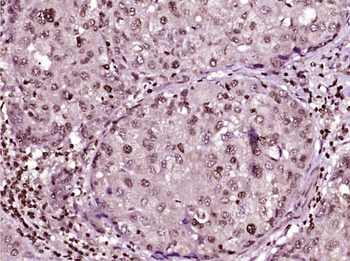 Phospho-HSP70 (Tyr611) Rabbit Polyclonal Antibody