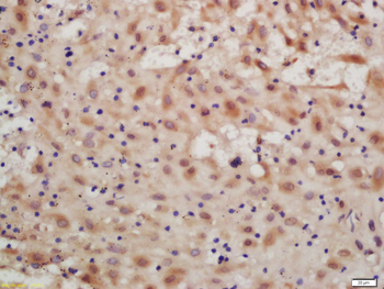 IKK beta Rabbit Polyclonal Antibody