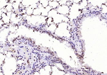KAT5 / Tip60 Rabbit Polyclonal Antibody