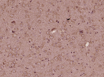 KIF13B Rabbit Polyclonal Antibody