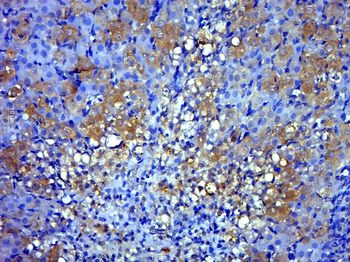 LAD1 Rabbit Polyclonal Antibody