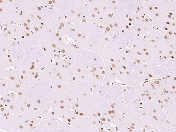 LMX1b Rabbit Polyclonal Antibody