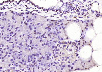 LMX1b Rabbit Polyclonal Antibody