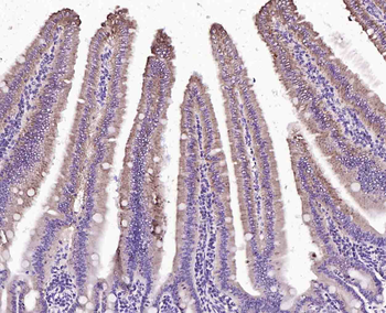 Monoamine Oxidase B Rabbit Polyclonal Antibody