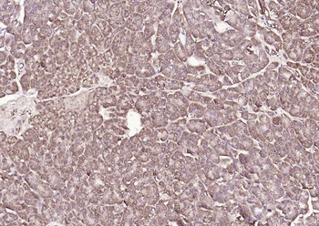 Monoamine Oxidase B Rabbit Polyclonal Antibody