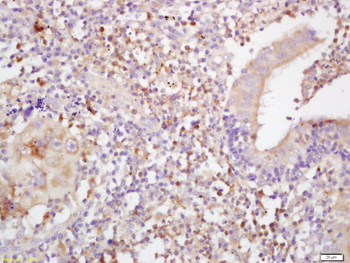 HLA-C Rabbit Polyclonal Antibody