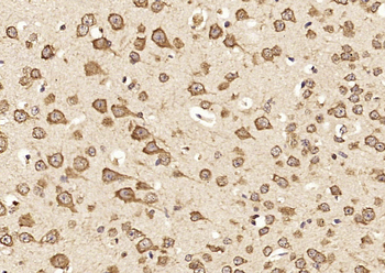 Munc13 Rabbit Polyclonal Antibody