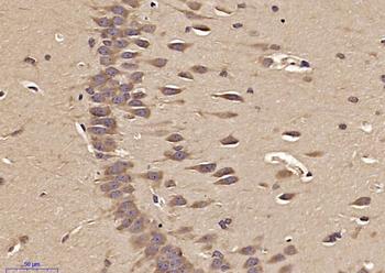 Munc13 Rabbit Polyclonal Antibody