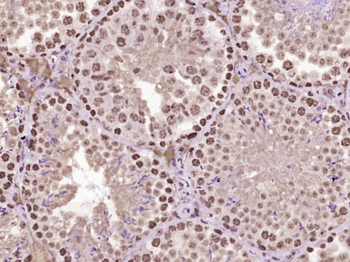 MYO6 Rabbit Polyclonal Antibody
