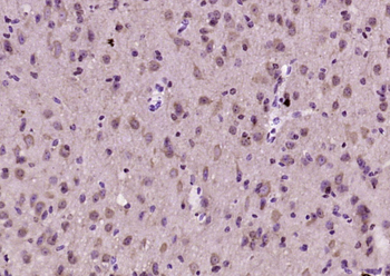 Netrin 5 Rabbit Polyclonal Antibody