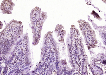NPEPPS Rabbit Polyclonal Antibody