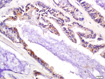 CDKN1A/P21 Rabbit Polyclonal Antibody
