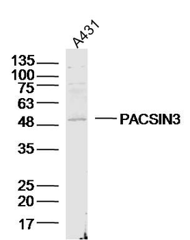 PACSIN3 Rabbit Polyclonal Antibody