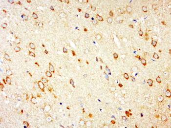 ATP13A2 Rabbit Polyclonal Antibody