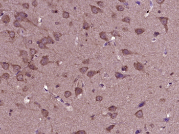 PDGFAA + PDGFBB Rabbit Polyclonal Antibody