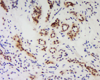 PPP1R10 Rabbit Polyclonal Antibody