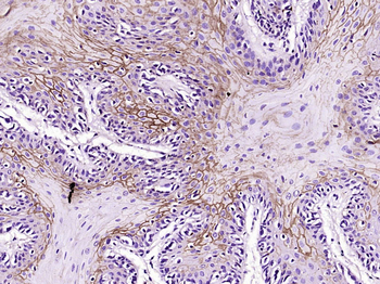 Progestin Receptor Beta Rabbit Polyclonal Antibody