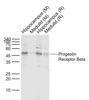 Progestin Receptor Beta Rabbit Polyclonal Antibody