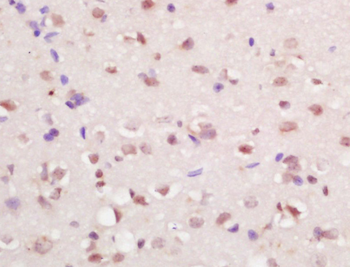 RFX4 Rabbit Polyclonal Antibody