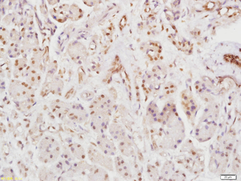 Rho B Rabbit Polyclonal Antibody