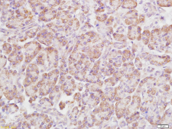 Rho B Rabbit Polyclonal Antibody
