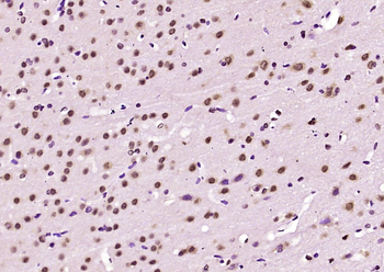 SAM68 Rabbit Polyclonal Antibody