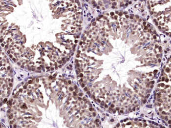 SHARPIN Rabbit Polyclonal Antibody