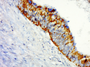SHROOM1 Rabbit Polyclonal Antibody