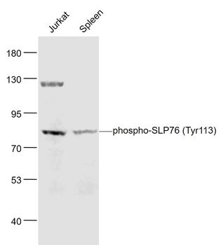Phospho-SLP76 (Tyr113) Rabbit Polyclonal Antibody