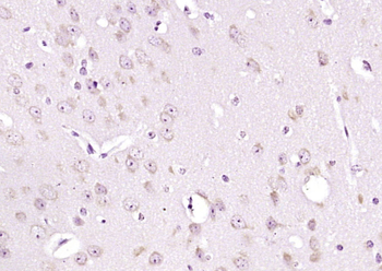 SPOCK2 Rabbit Polyclonal Antibody
