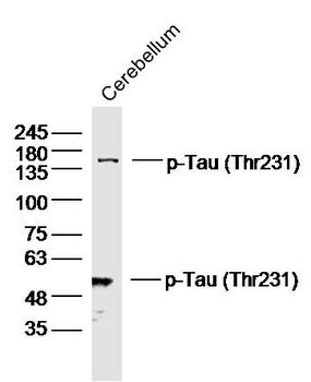 Phospho-Tau (Thr548) Rabbit Polyclonal Antibody