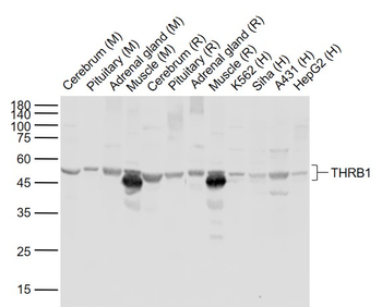 THRB1 Rabbit Polyclonal Antibody